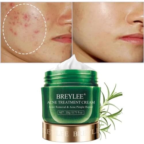 BREYLEE Tea Tree Acne Treatment Cream Anti Acne Face Cream Pimple Removal Spots Oil Control Shrink Pores Moisturizing Skin Care