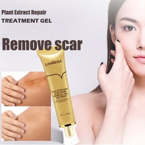 30g Acne Scar Removal Cream Pimples Stretch Marks Face Gel Remove Acne Smoothing Whitening Moisturizing Body Skin Care Aichun
