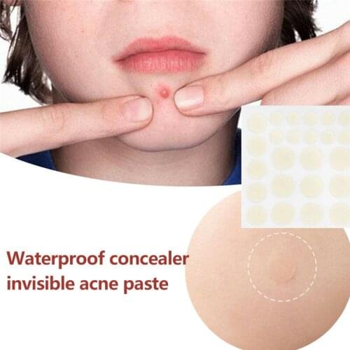 36Pcs Acne Pimple Patch Invisible Acne Stickers Effectively Remove Pimples Acne Treatment Mask Skin Care Tool Blemish Removers