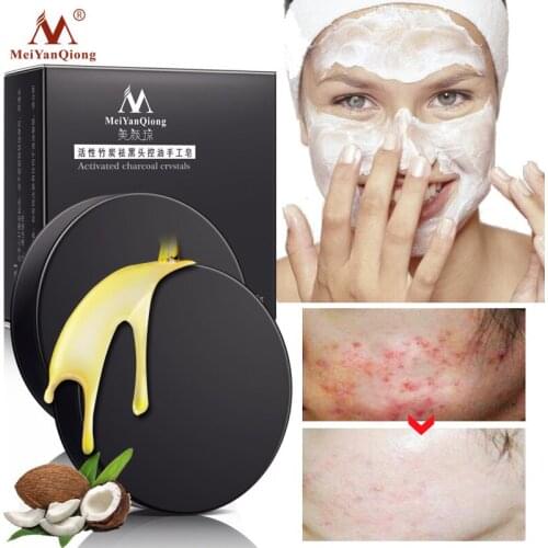 Acne Treatment Handmade Soap Activated Carbon Remove Blackhead Facial Cleansing Soap Moisture Oil Control Whitening Shrink Pore