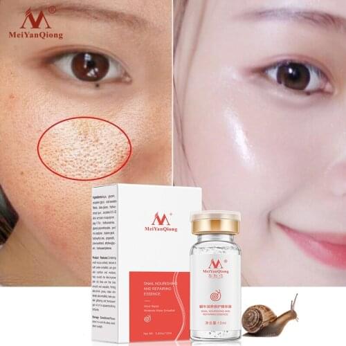 High Quality Snail100% Essence Hyaluronic Acid Liquid Whitening Spot Essence Shrink Pores Ampoule Anti-acne Regenerative Essence