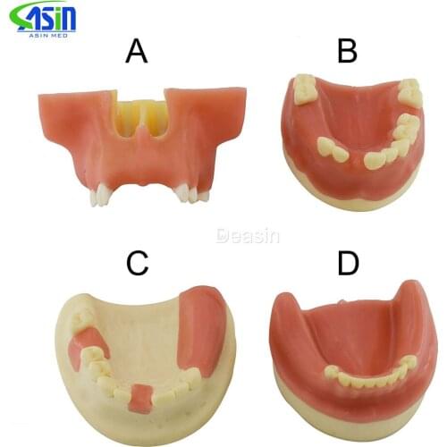 High quality Dental implant training model Oral implant training practice model Maxillary sinus lifting exercises