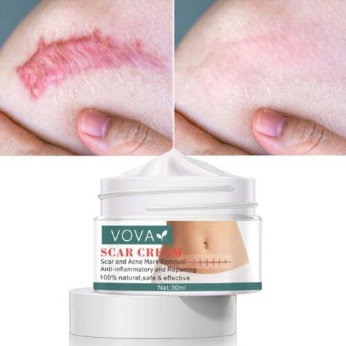 30ml Scar Cream Deeply Permeate Soften Cuticle Skin Care Acne Stretch Marks Removal Cream for Adult
