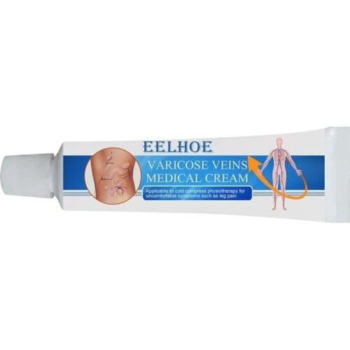 16g Varicose Veins Miracle Ointment Cream Relief Pain For Vasculitis Phlebitis Tube Effective Varicose Vein Relief Cream
