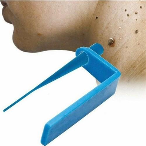 Nevus Corns And Wart Durable Remover With Groove Design Skin Care Gift Nevus Removing Tool Nevus Remover