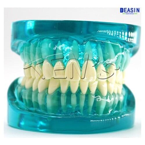 Dental oral dental pathology model Doctor-patient communication model Teaching tooth model detachable decomposition model