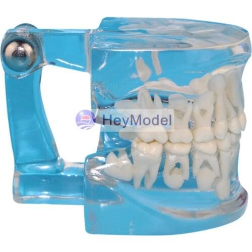 HeyModel Full transparent deciduous teeth permanent tooth alternating model