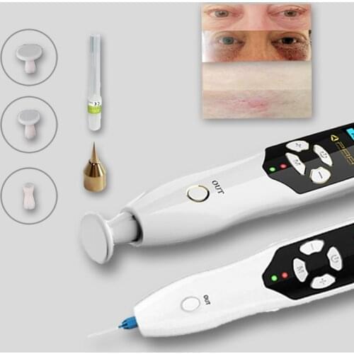 Ozone plasma jet lift eyelid lifting pen fibroblast plasma stkin tag remover mole warts removal machine