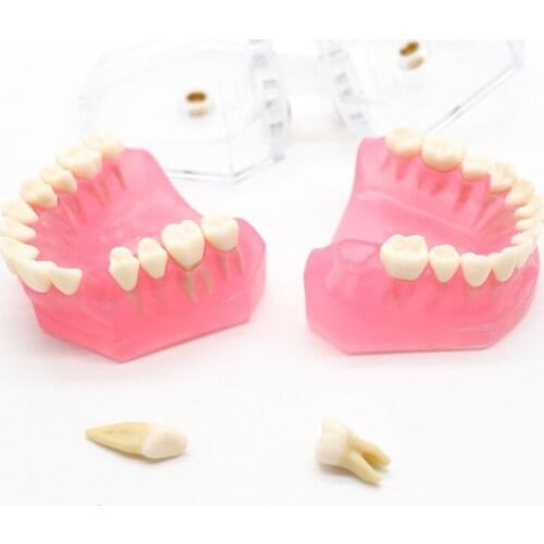 Dental Clinic Study Teaching Model Removable Soft Gum typodont Model For Teaching 1set