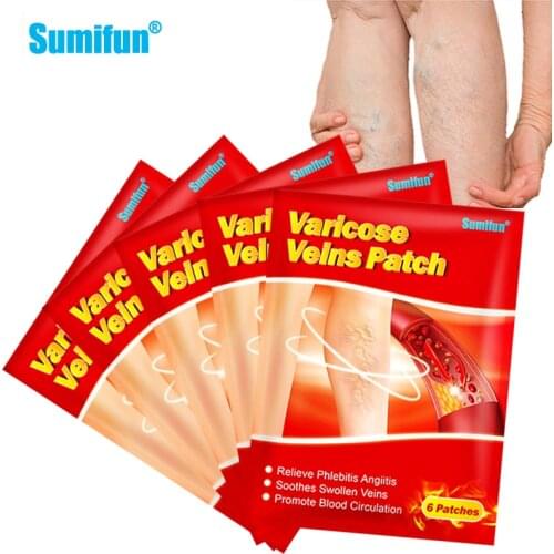 12/30Pcs Varicose Veins Treatment Patch Varicosity Angiitis Remedy Relief Veins Pain Phlebitis Legs Varicose Veins Plaster