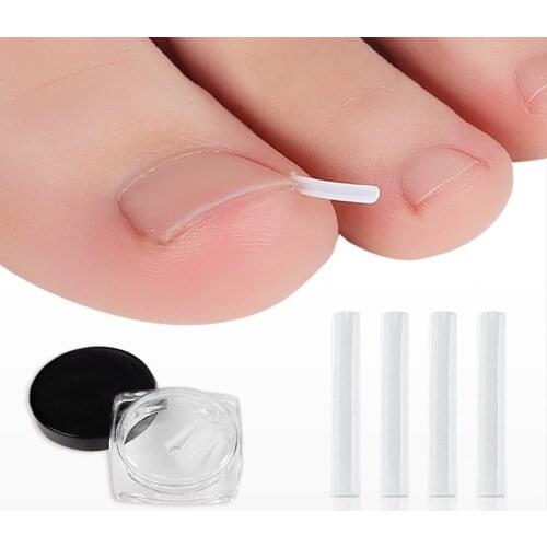10PCS Ingrown Pads Ingrown Toenail Pads Ingrown Nail Pads Ingrowing Nail Braces Ingrowing Nail Artifacts Orthopedic Foot Care