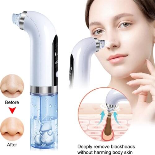USB Blackhead Meter Electric Vacuum Blackhead Acne Pore Cleaner Water Cycle Skin Deep Cleaning Small Bubbles Beauty Care Tools