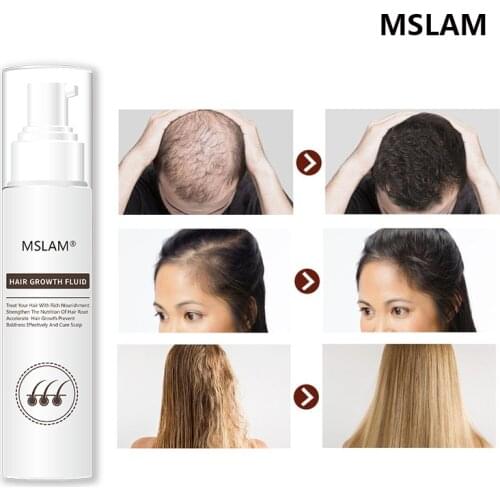 MSLAM Growth Products Fast Growing Hair Oil Hair Loss Care Beauty Hair & Scalp Treatment for Men Women