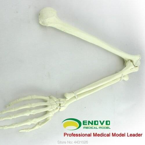 ENOVO The artificial cortical bone cancellous bone graft was implanted into the simulation model