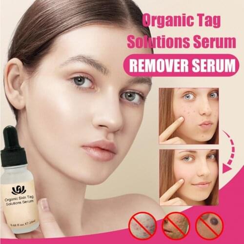 10ml/20ml Fade Spots Tag Serum Non-Irritating Natural Extract Skin Remover Solutions Exfoliante Beauty Serum for Female
