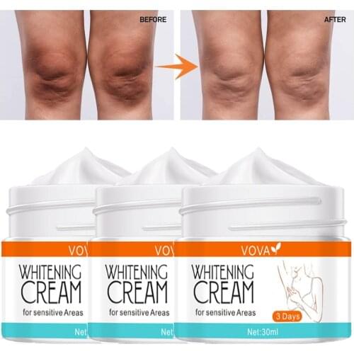 30ml Armpit Whitening Cream Moisturizing Body Lotion Legs Knees Underarm Dark Skin Lightening Cream Bleaching Intimate Care