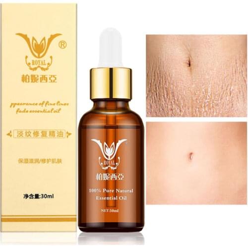 Body Repair Essential Oils Remove Pregnancy Vibration Lines Postpartum Lines Obesity Lines Nourish Anti-Wrinkle Skin Care 30ml