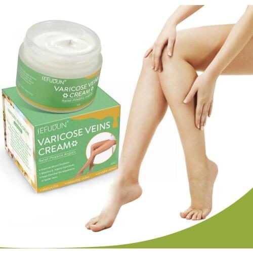 New Varicose Veins Cream Of Varicose Veins Medical Herbal Medicine Treatment 50g Ointment Varicose Veins Veins Spider Chine N9F7