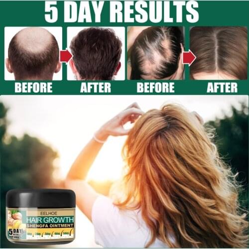 Eelhoe 30ml Hair Growth Cream Moroccan Germination Cream Hair Repair Cream Fast Growth Cream Massage Hair Care New 2021 TSLM1