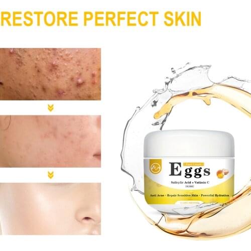 Minch Salicylic Acid Face Cream Egg Extract Repair Acne Face Cream Repair Sensitive Skin Vitamin C Anti-acne Shrinks Pore Cream