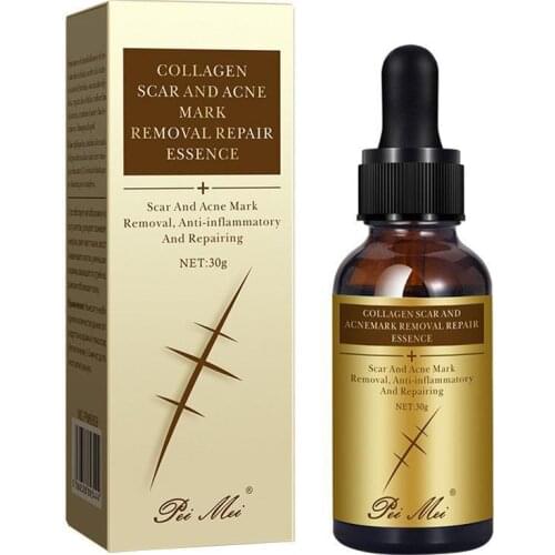 30ml Imprint Repair Fluid Essence Skin Essential Oil Natural Remove Ance Burn Strentch Marks Scar Removal Skin Care Product