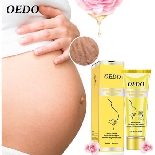Stretch Marks Remover Cream Skin Care Treatment Cream For Postpartum Obesity Pregnant Repair Anti-Winkles Firming Body Cream