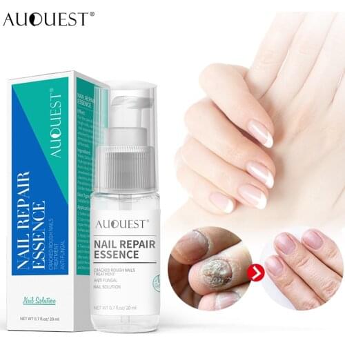 AuQuest Nail Repair Essence Foot Nail Fungus Removal Hand Foot Nail Care Infection Nail Treatment 20ml