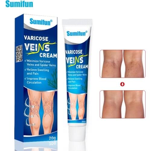 Sumifun 1box New Hot Varicose Veins Treatment Cream Vasculitis Phlebitis Spider Leg Ointment Varicosity Angiitis Removal Patch