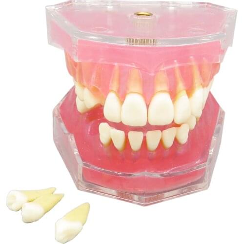 Dental Typodont Standard Teeth Model Soft Gum 28Pcs Removable Teeth #4004