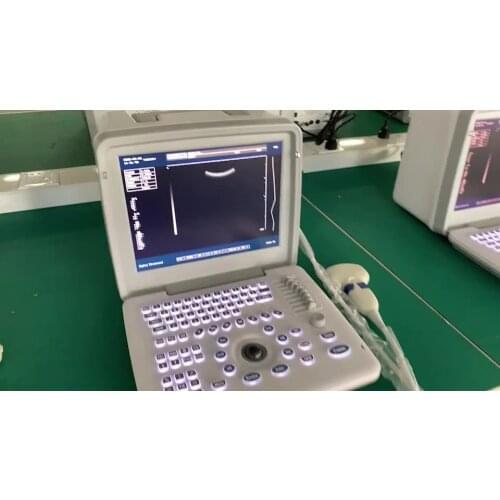 Hospital Equipment Full Digital Portable B Mode Ultrasound Scanner Machine