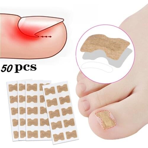 Ingrown toenail paronychia correction patch treatment fixative restoration corrector pedicure toe nail care tool elastic patch