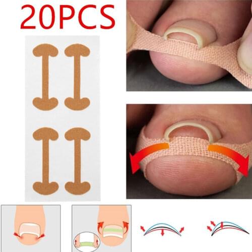 20pcs Professional Embedded Toe Nail Corrector Sticker Toenail Care Pedicure Thumb Curl Correction Sticker Health Care