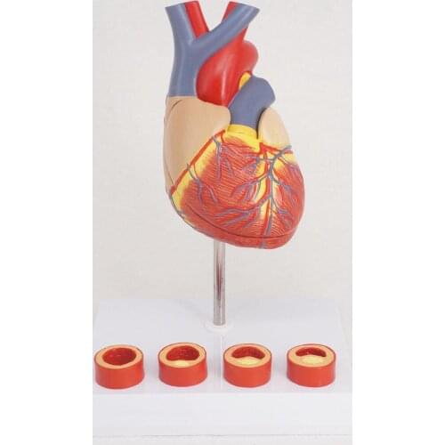 Life Size Human Heart Anatomy Model With 4 Stage Vascular Mounted on White Base Cardiac Learn for Education