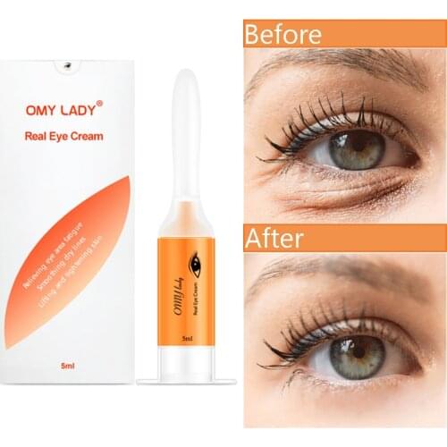 5ml Eye Cream Anti Puffiness Instant Remove Dark Circles Eyes Serum Anti Aging Anti-wrinkle Moisturizing Skin Care Eyes Cream