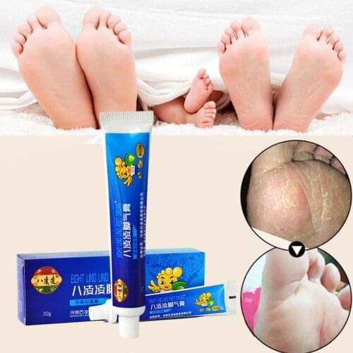 1Pcs Antifungal Infections Foot Cream For Athletes Relief Erosion Pain Peeling Itch Beriberi Ointment Feet Blisters Foot N8R5