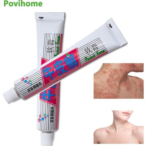 25g Skin Psoriasis Cream Dermatitis Eczematoid Ointment Pruritus Anti Itching Antibacterial Herbal Balm Skin Cleaning Cream