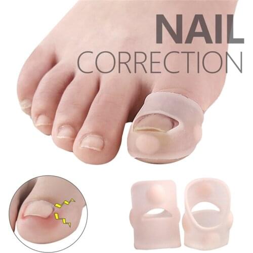 1Pair Silicone Ingrown Toenail Correction Tool Invisible Ingrown Toenail Treatment Elastic Straightening Clip Brace