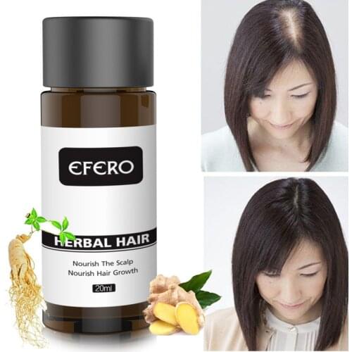 Hot sale Fast Hair Growth Essence Oil Hair Loss Treatment Help for hair Growth Hair Care 20ml
