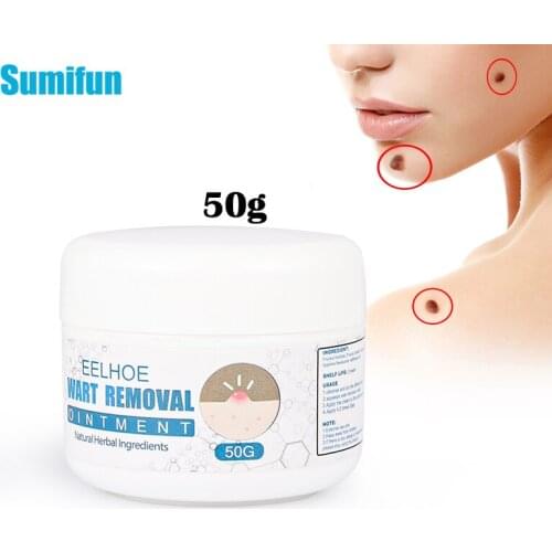 50g Warts Remover Antibacterial Ointment Wart Treatment Cream Skin Tag Remover Herbal Extract Corn Plaster Warts Ointment