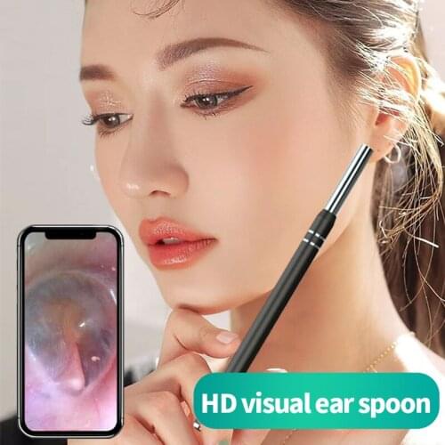 Video Otoscope Cleaner 3 in 1 Smart Visual Ear Cleaning Endoscope 5.5mm Usb C Earpick Camera Otoscopio Medico Digital for Animal
