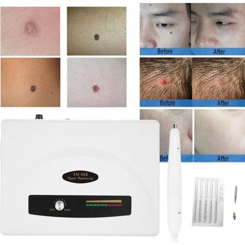Ultrasonic Spot Removal Pen Machine Facial Body Freckle Tattoo Dot Mole Plasma Wart Removal Remover Beauty SPA Home Skin Care