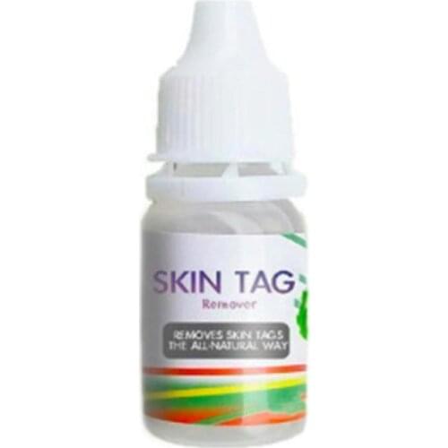 Warts Remover Liquid Foot Corn Skin Tag Removal Essence Wart Treatment Cream Natural Herbal Extract Medical Plaster Skin Care