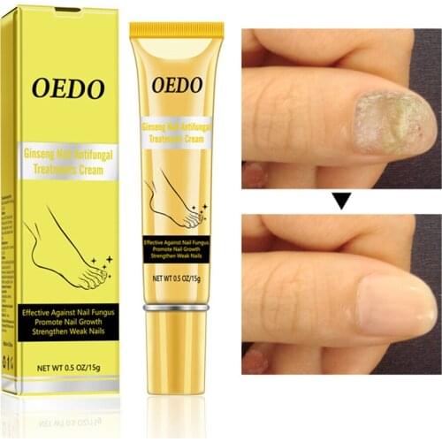 Nail Cream Water Alcohol Artemisia Argyi Leaf Extract Prevent Crack Prevent Falling Off Hand Skin Multi Effect Maintenance