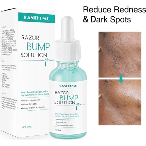 Men Women Razor Burns Solution After Shave Razor Bump Stopper Reduce Dark Spots Redness Ingrown Hair Treatment
