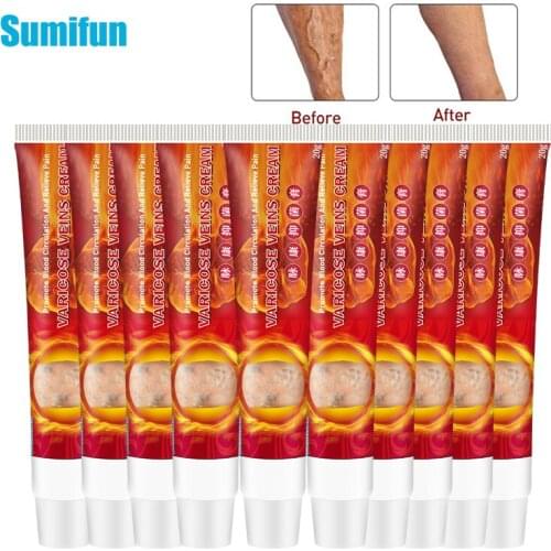 10pcs Sumifun Varicose Veins Treatment Cream 100% Original Vasculitis Phlebitis Spider Medical Pain Relief Ointment Skin Care