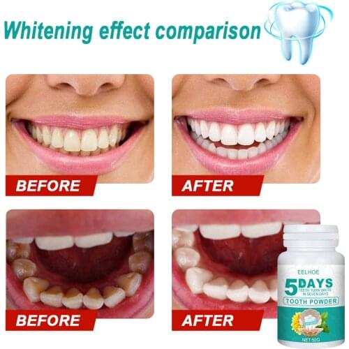 100g Tooth Whitening Essence Powder Clean Oral Hygiene Whiten Teeth Remove Plaque Stains Fresh Breath Oral Hygiene Dental Tools