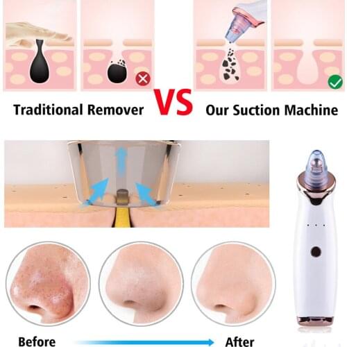 Electric Acne Remover Point Noir Blackhead Vacuum Extractor Tool Black Spots Pore Cleaner Skin Care Facial Pore Cleaner Machine