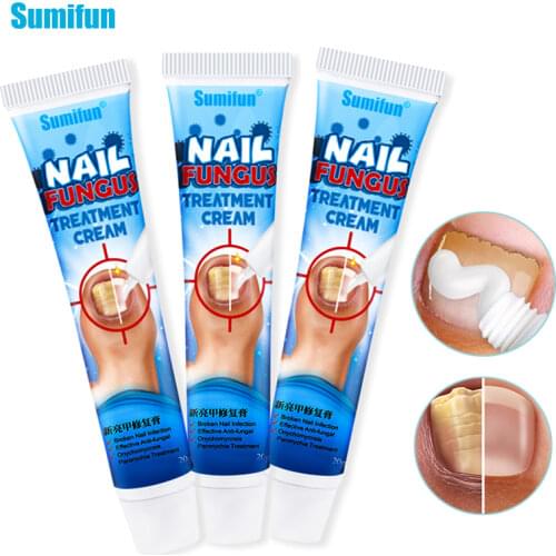 Sumifun 1/2/3PCS Fungal Nail Repair Cream Care Treatment Foot Nail Fungus Removal Ointment Anti Paronychia Onychomycosis