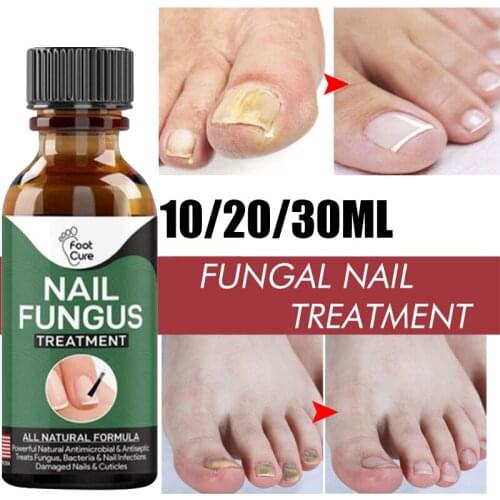 10/20/30ml Treatment Nail Repair Serum Care Foot Toe Nail Fungus Anti-sensitive Removal Paronychia Onychomycosis Essences
