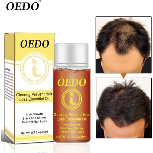 Ginseng Hair Growth Anti-off Essential Oil Repair Damage Hair Speed Promotes Hair Growth Nourish Thick Roots Repair Dry Hair